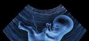 怀孕血糖高对胎儿有什么影响 孕妇血糖高对胎儿有什么影响吗