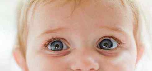 红眼病多久能好 宝宝结膜炎多久能好   结膜炎治愈时间介绍