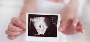 胎儿9个月在腹中图片 9个月胎儿死在腹中症状