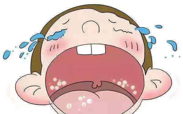 婴儿口腔上颚有白点 婴儿口腔上颚发白？小心鹅口疮来袭！