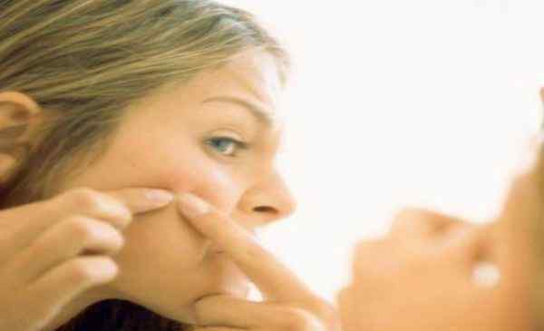 激素脸的症状 激素脸的症状 三种症状检测你是否是激素脸