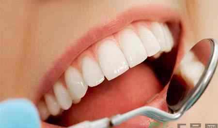 冷光美白牙齿的价格 冷光美白牙齿的价格是多少？做冷光美白牙齿需要多少钱？