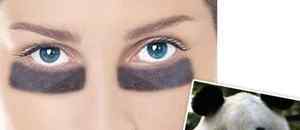黑眼圈严重的原因 黑眼圈很重是什么原因？深扒三类黑眼圈的成因