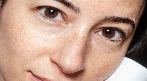 面部皮肤保养 如何保养脸部皮肤 皮肤护理知识