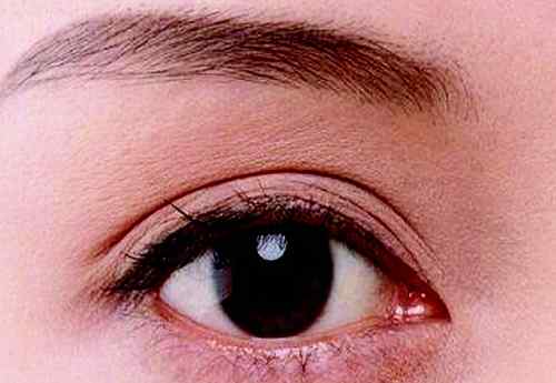 眼皮浮肿的原因 眼睑水肿的症状
