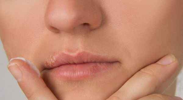 女性唇毛多 女性造成唇毛的原因是什么 为什么女性会长唇毛