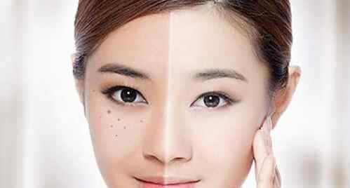 激光祛斑缺点 激光祛斑后多久能化妆?激光祛斑后多久可以化妆?