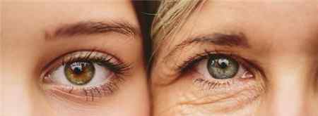 眼袋是怎么形成的 泪沟是怎么形成的?泪沟和眼袋的区别