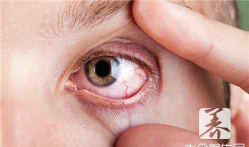 眼球震颤会遗传吗 老公的眼球震颤会遗传吗？