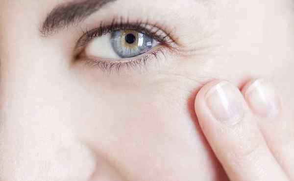 去眼周细纹 干纹和细纹的区别 眼周有干纹怎么办