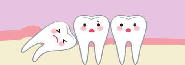 牙龈发炎一般几天自愈 智齿发炎一般几天能好 智齿发炎恢复时间与发炎程度有关