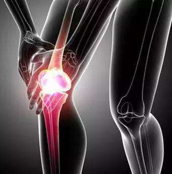 关节炎病因 膝关节炎病因及治疗 膝关节炎需要怎么治疗