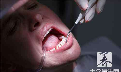 牙垢和牙石清除小窍门 牙垢和牙石清除小窍门有哪些