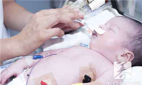 宝宝脑缺氧的早期表现 宝宝出生时缺氧的表现