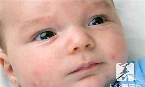 婴儿双眼皮的线条图 婴儿双眼皮印子的图片