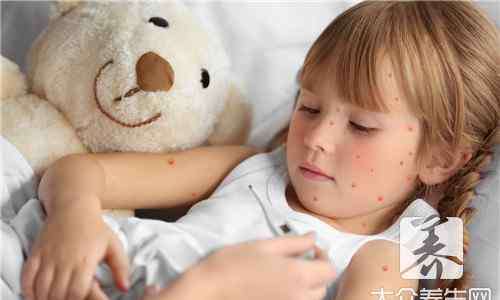 幼儿急疹的症状 幼儿急疹什么样子图片