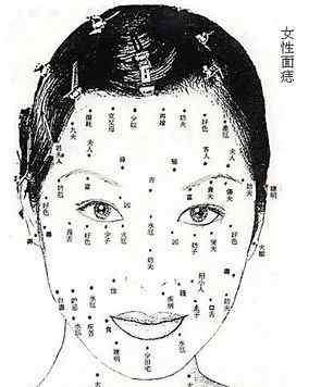 女人右脸的痣图解 女人右脸有痣图解，女人脸上有哪些痣是不可以点的？