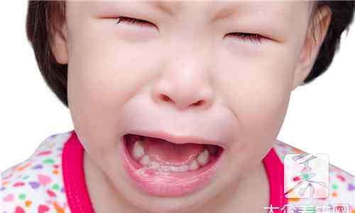 婴儿口腔溃疡怎么办 宝宝口腔溃疡怎么办？如何护理？