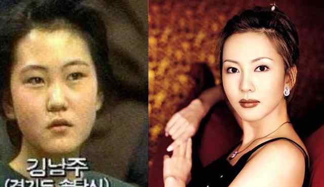 金贤珠整容 47岁女星承认整容变脸-金南珠没整容之前照片曝光